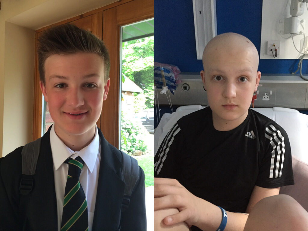 Candid With Cancer #1 – My First Cancer Diagnosis